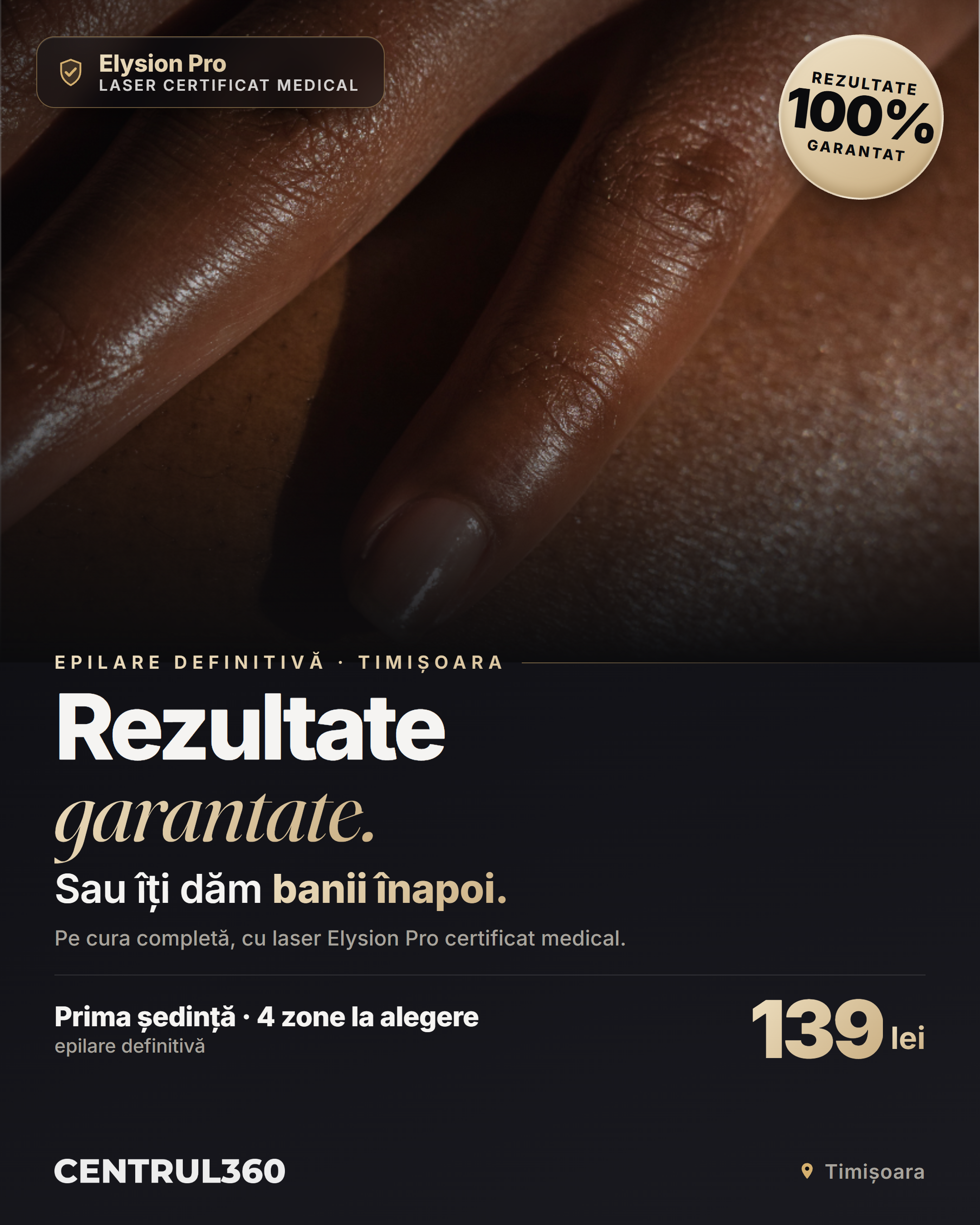Epilare laser 4 zone